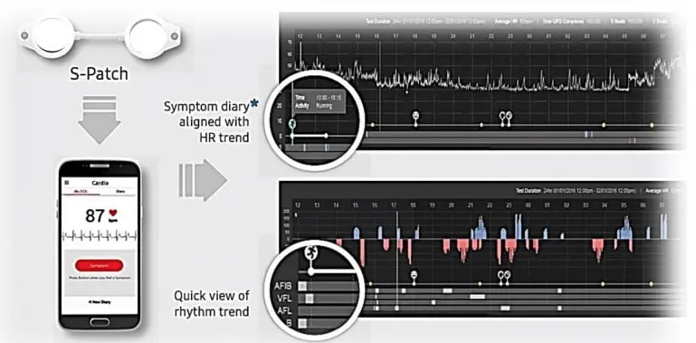 Modern Heart Rate Recording System