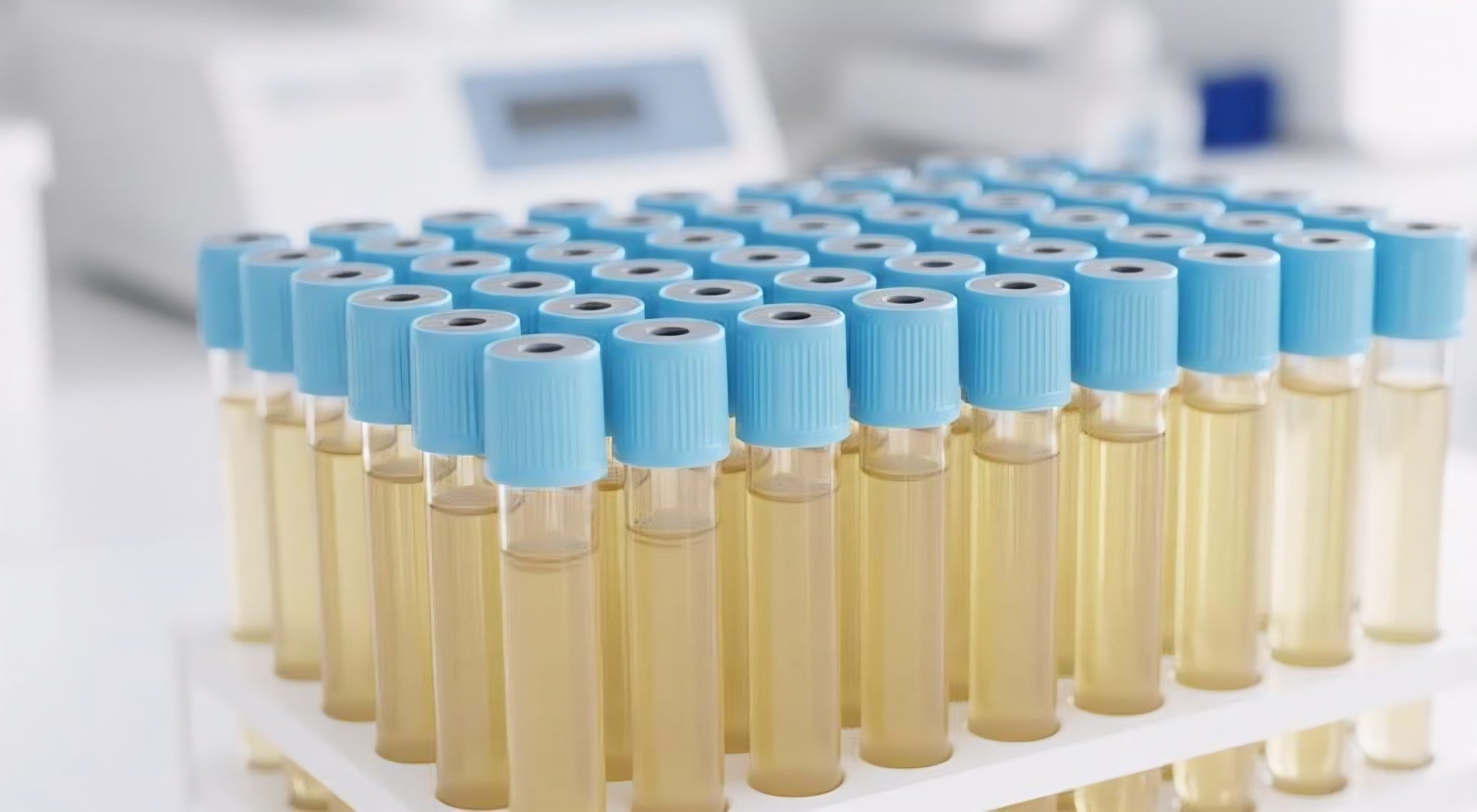 Ανοσολογικές Εξετάσεις Αίματος