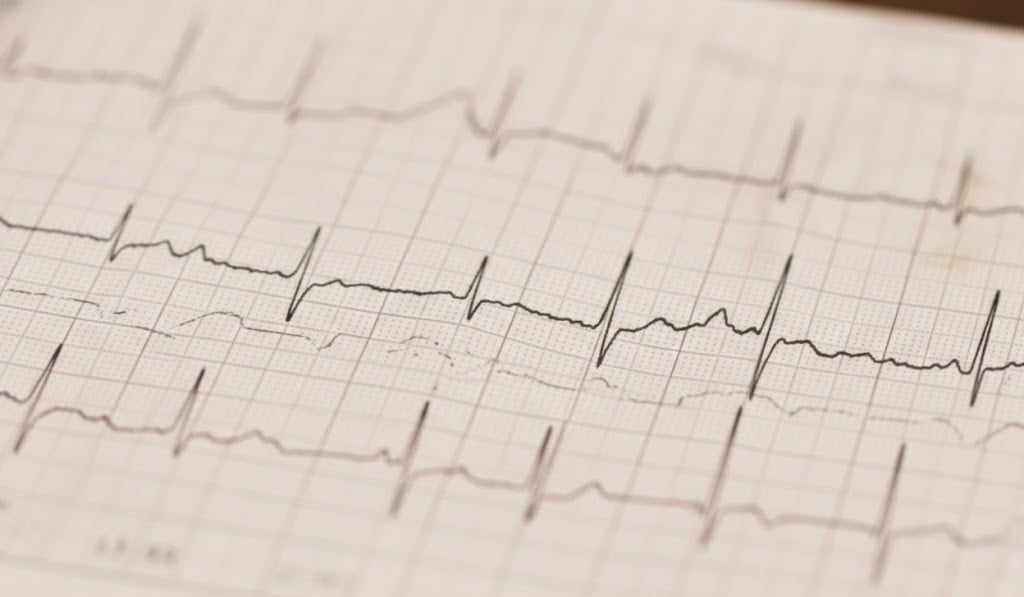 Holter Ρυθμού 24ώρου στο Σπίτι