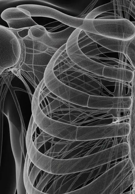 Rib cage X-ray