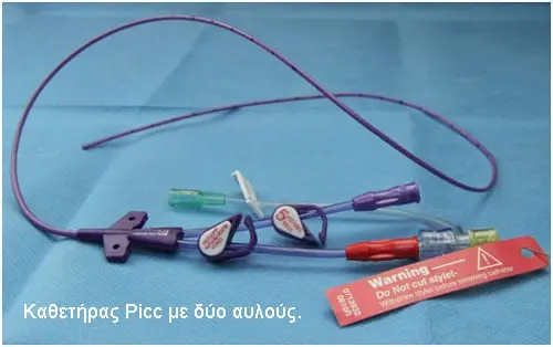 Double-lumen peripherally inserted central catheter (PICC)