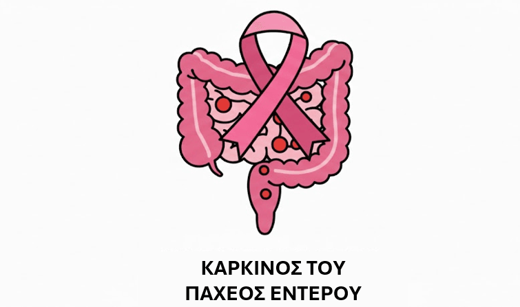 Illustration of the intestine and ribbon