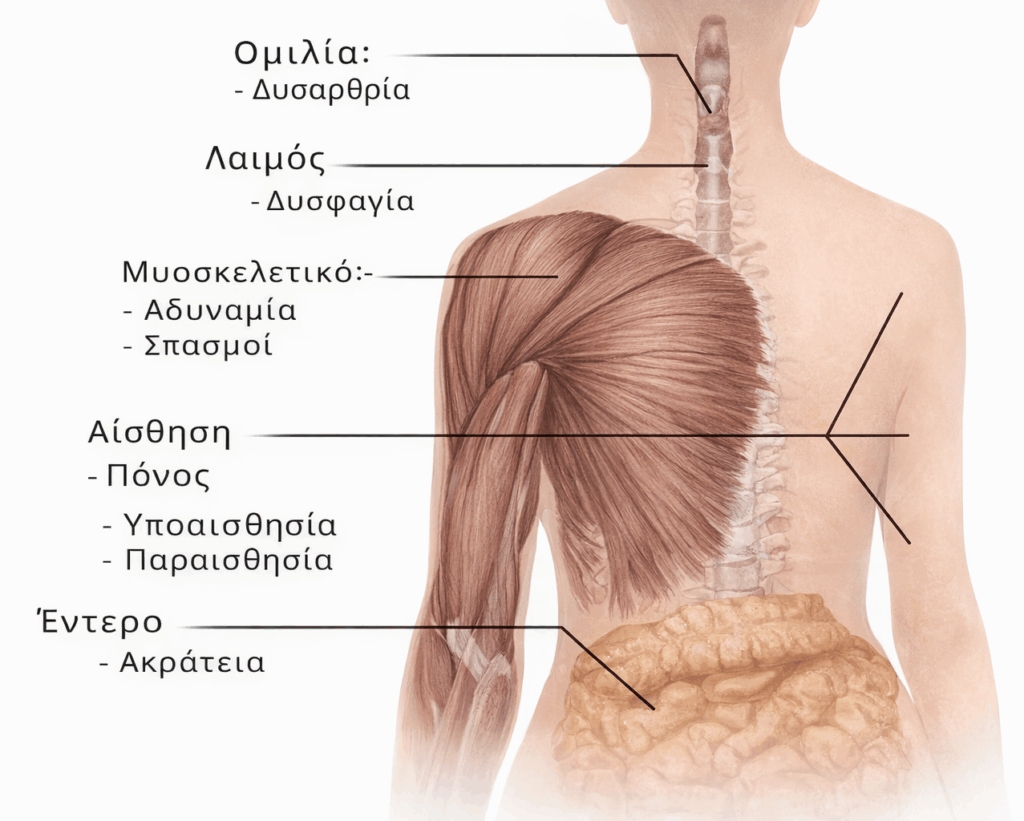 Σκλήρυνση κατά πλάκας – προσβολή νευρικού συστήματος